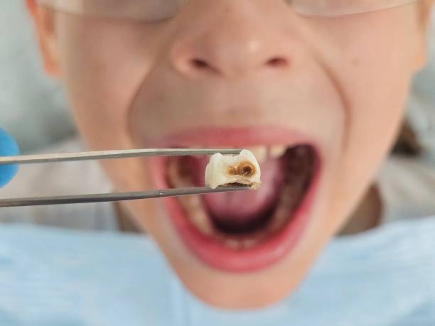 Best Emergency Dental Extractions in Village Of The Branch, NY